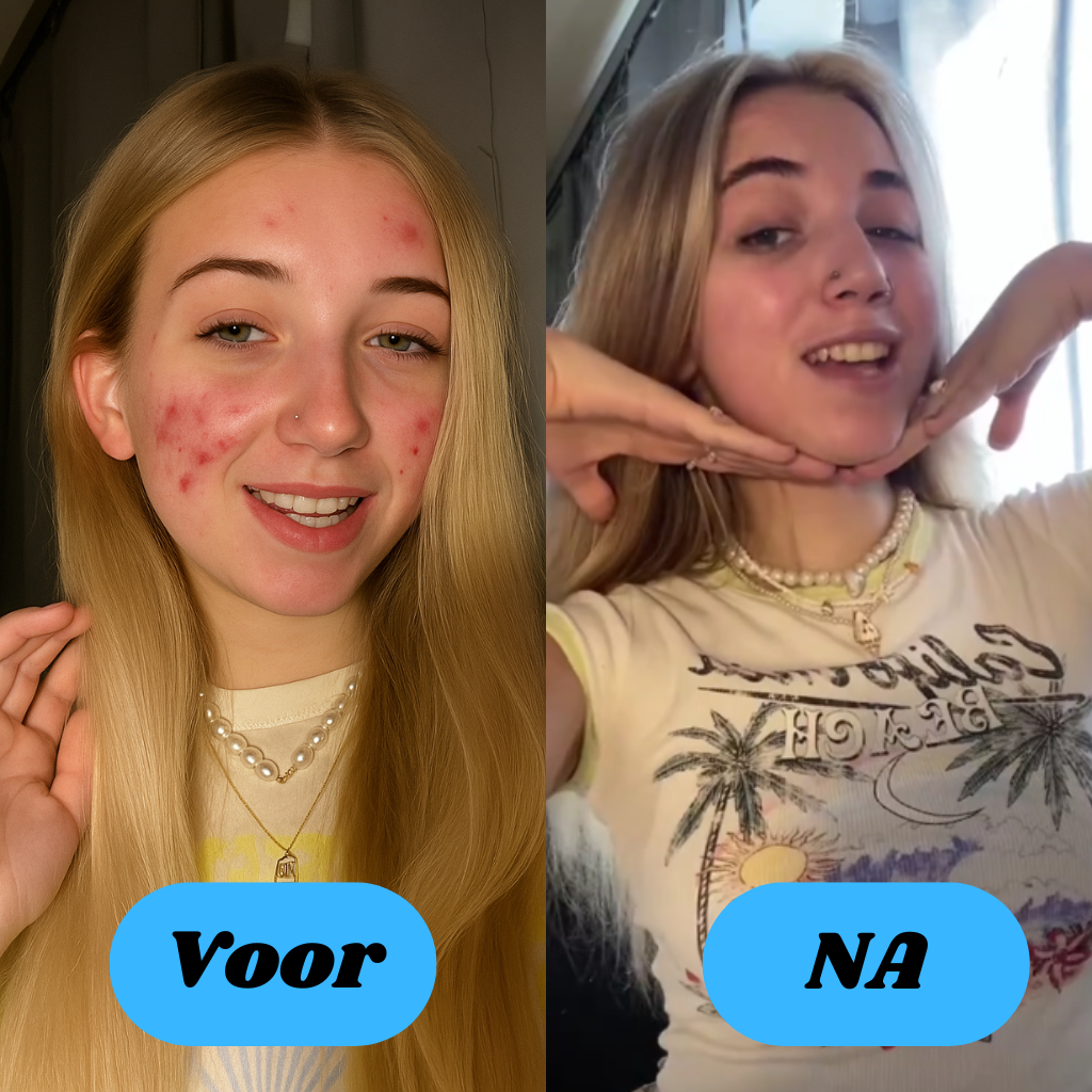 IceBowlie® + GRATIS Oce- Aloe Gel